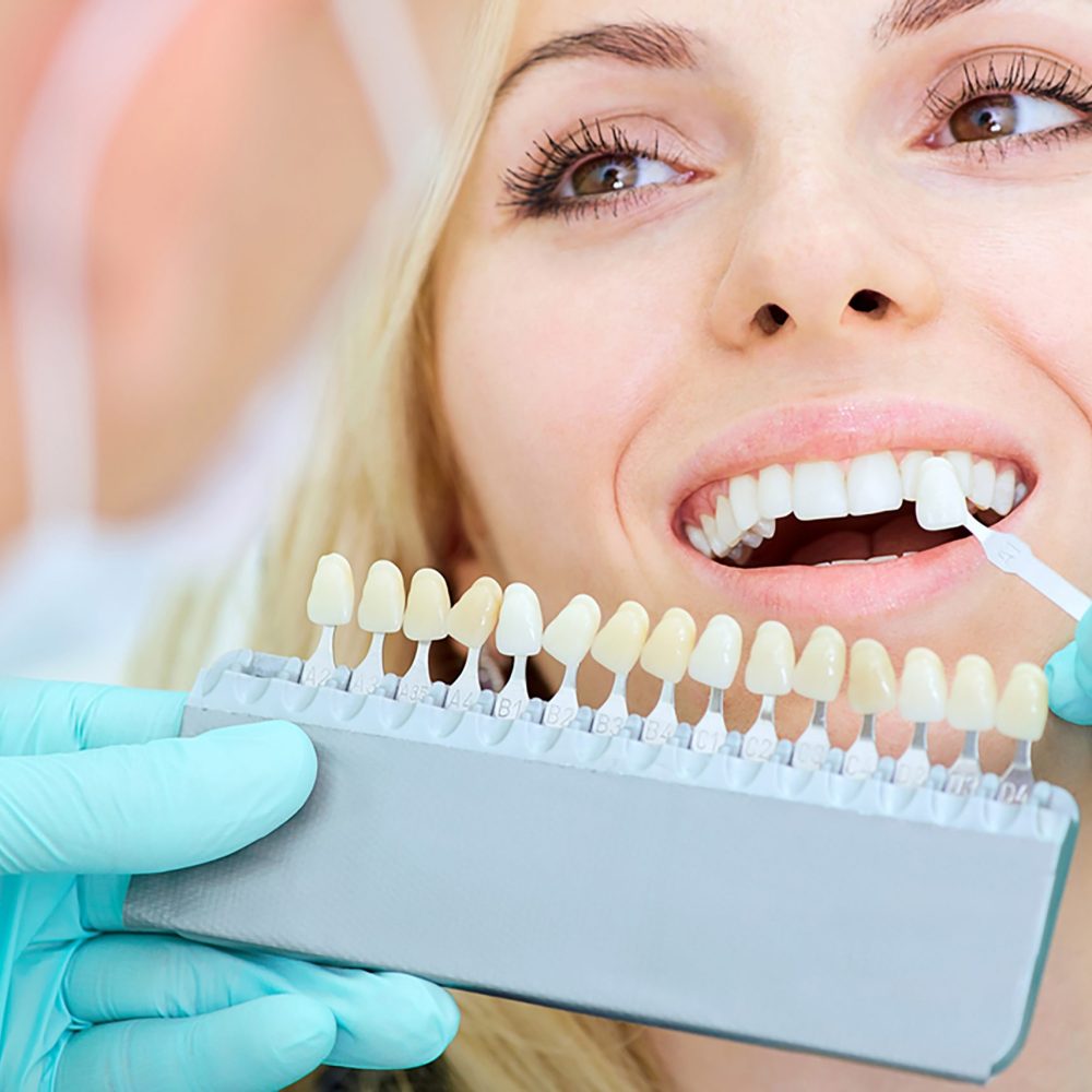 10-things-you-should-know-about-teeth-whitening-scaled